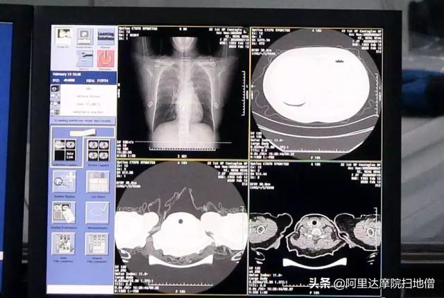 AI技术目前很发达了吗？